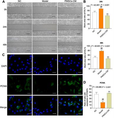 Intra-articular injection of placental mesenchymal stromal cells ameliorates pain and cartilage anabolism/catabolism in knee osteoarthritis
